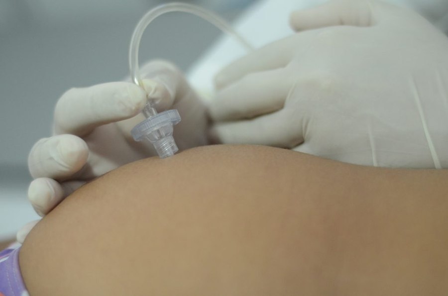 Aplicação de carboxiterapia na Clínica Thiago Gusmão